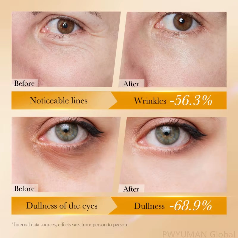 Retinol anti Wrinkle Eye Serum Peptide Remove Dark Circles Eye Bags Puffiness Cream Moisturizing Repairing Korean Skincare New